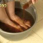 Три ефективни рецепти за лечение на гъбички по ноктите