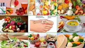 Как да се справим с подаграта: доказани методи за лечение и превенция